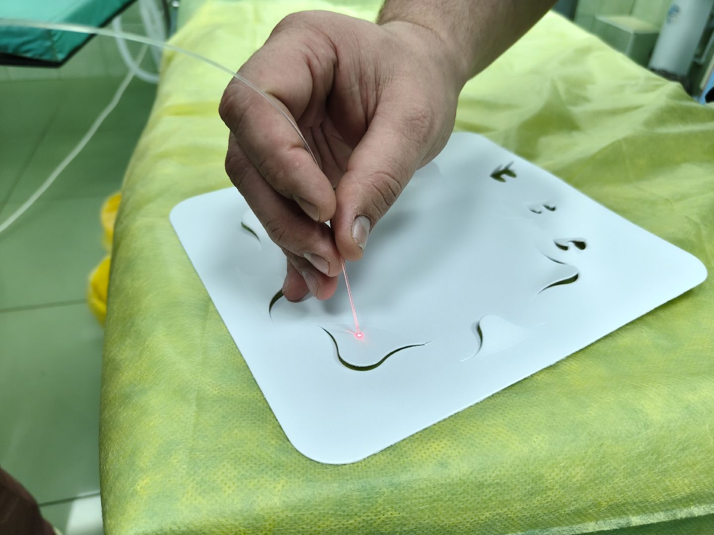 наро-фоминская больница, апрелевка, лазерный аппарат, варикоз, хирургическое отделение, сосудистый хирург,