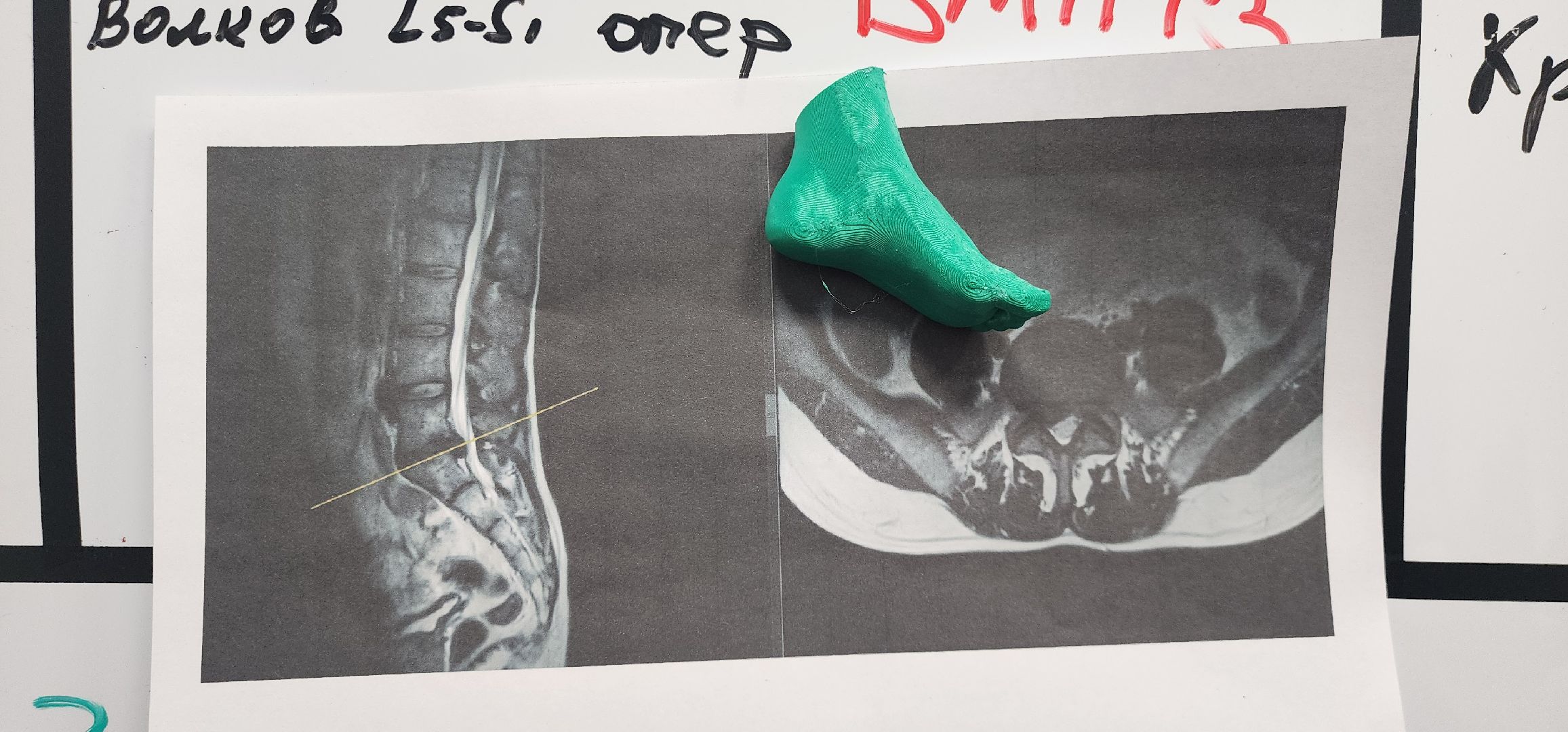 Истра, Хирург, Медицина, Нейрохирург,