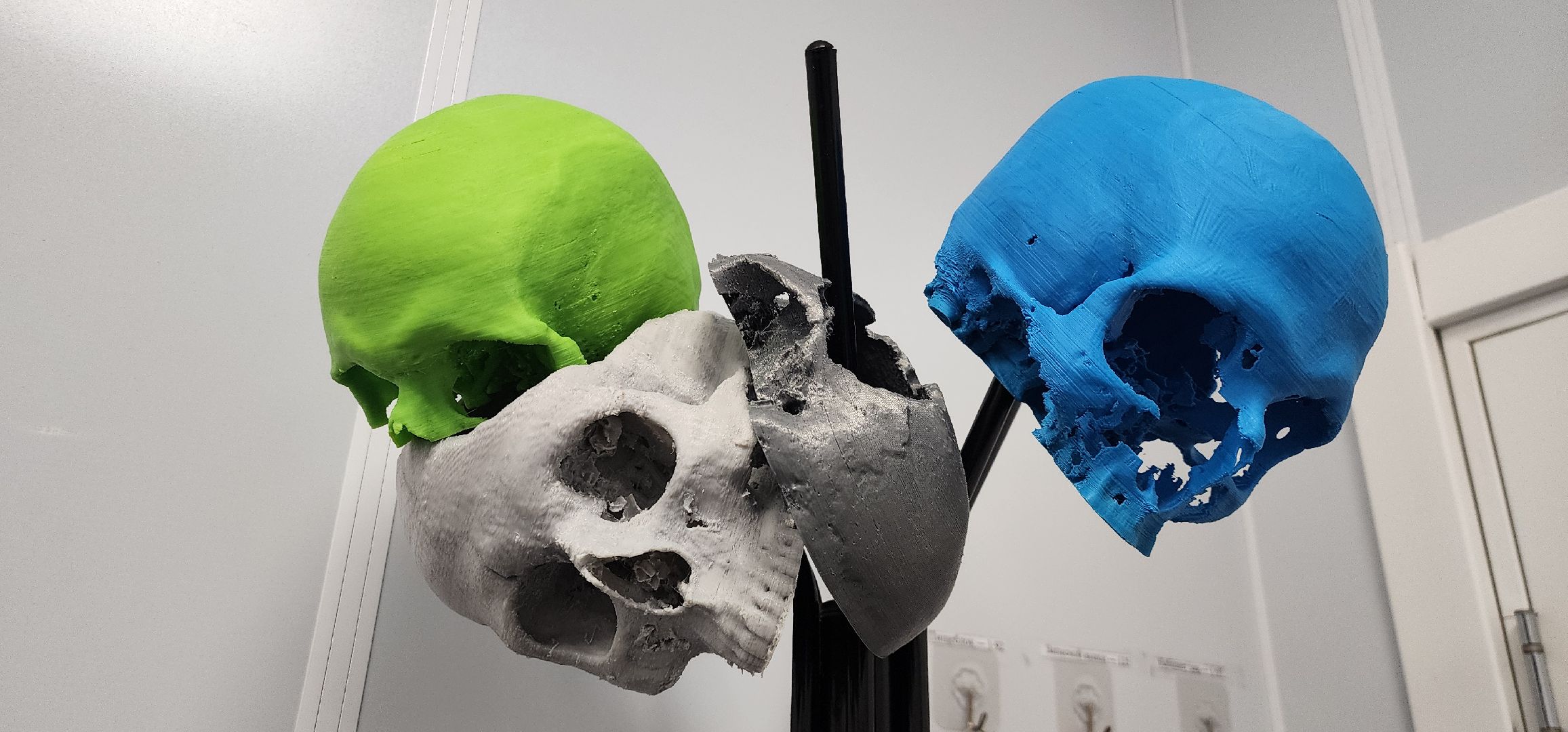 Истра, Хирург, Медицина, Нейрохирург,