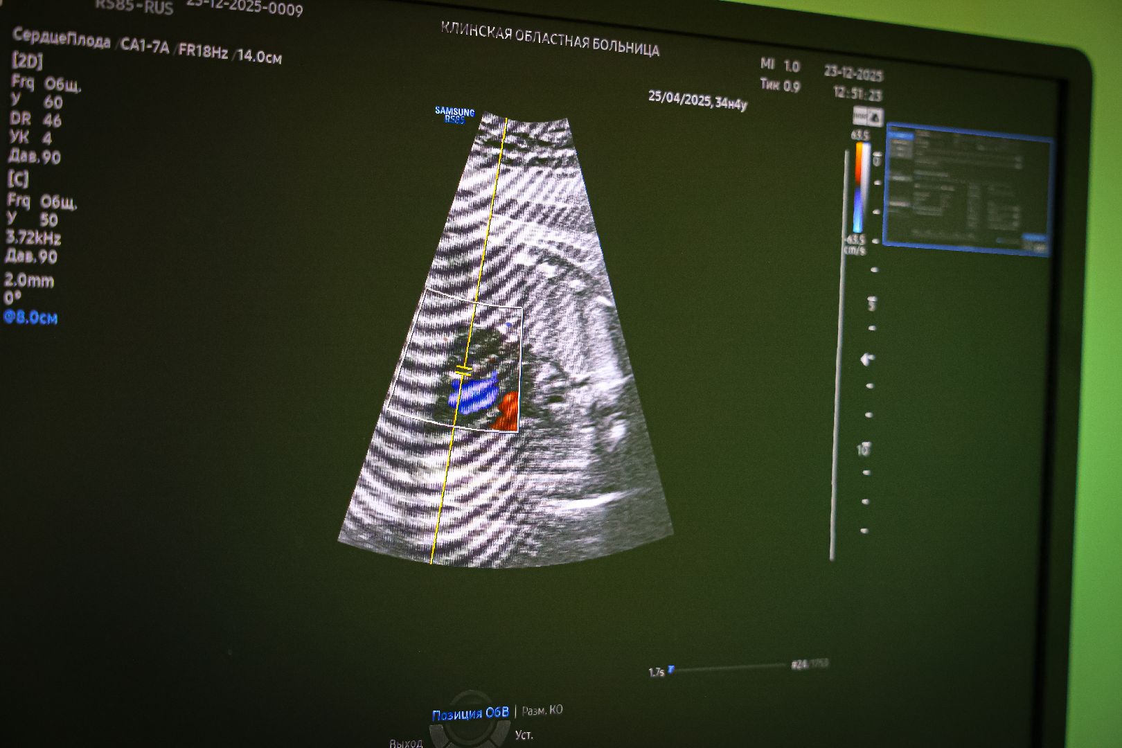 клин, медицина, семьи, подмосковье, роды в подмосковье,