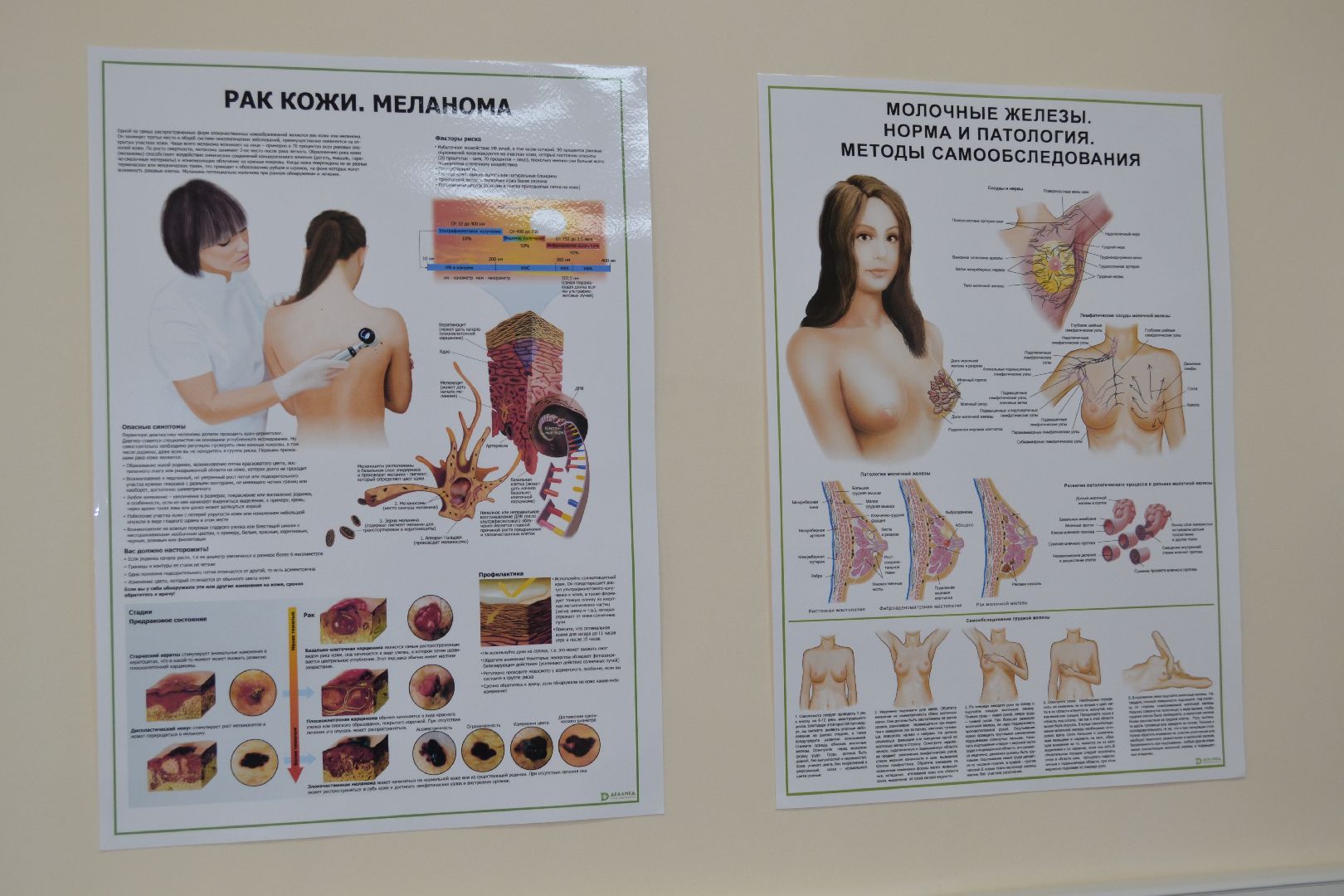 Балашиха, Подмосковье, медицина, онкология, рак кожи, меланома, МООД