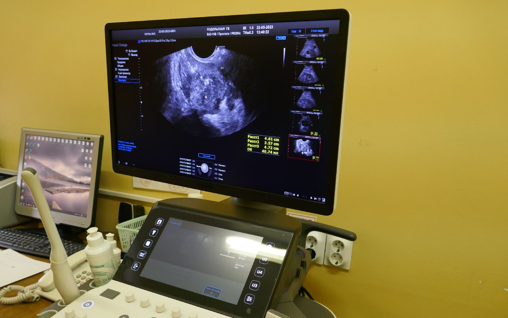 Подольск, медицина, больница в Подольске, эндоскопия, врач, операционная, оборудование, лечение, помощь, здоровье